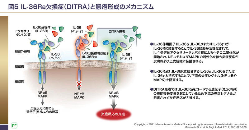 GPPの病態におけるIL-36の役割05