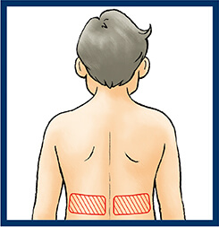 図1 捻髪音が聴取される部位