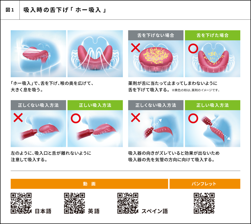 copd_23vol3_Bplus_06