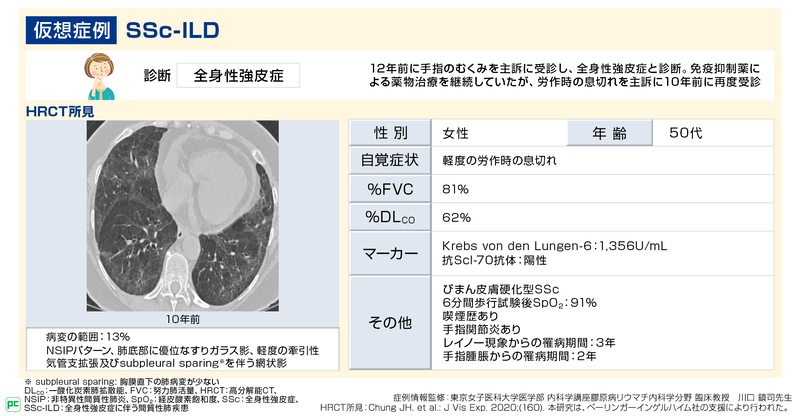 全身性強皮症に伴う間質性肺疾患（SSc-ILD）の診断と治療（静止画）01