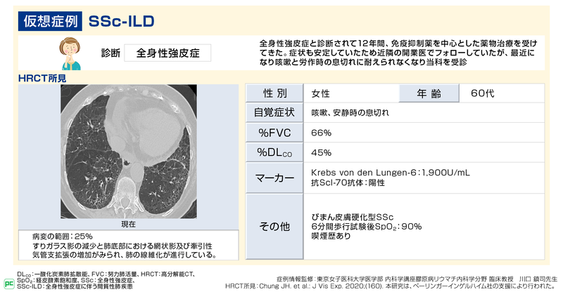 全身性強皮症に伴う間質性肺疾患（SSc-ILD）の診断と治療（静止画）02
