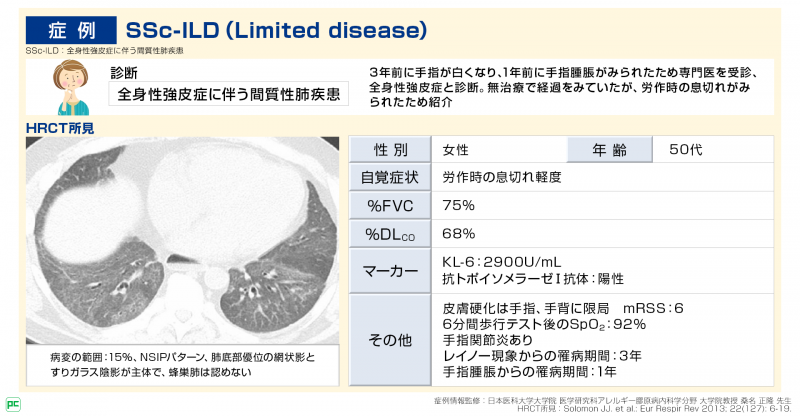 SSc-ILD （Limited disease）