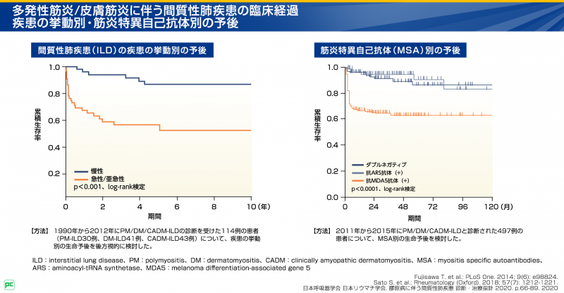 多発性筋炎/皮膚筋炎に伴う間質性肺疾患（PM/DM-ILD）患者さんの予後