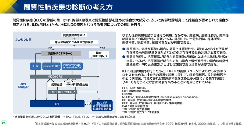 ILD診断におけるMDDの位置づけと検討内容