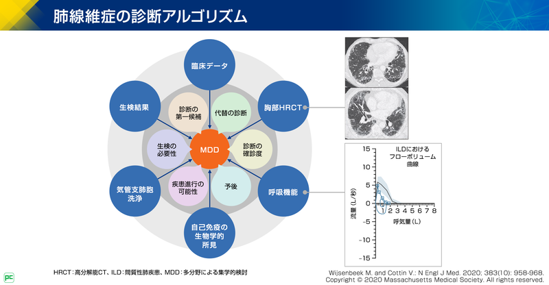 ILD診断におけるMDDの位置づけと検討内容03