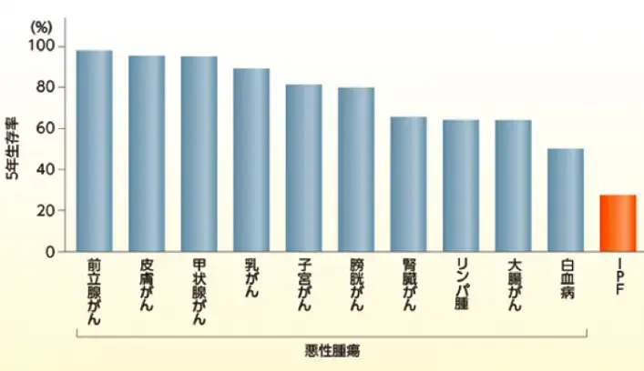 IPF患者とがん患者の5年生存率