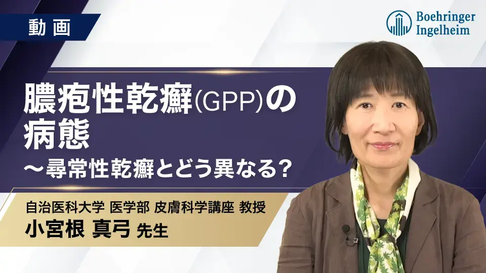 膿疱性乾癬（汎発型）の病態〜尋常性乾癬とどう異なる？
